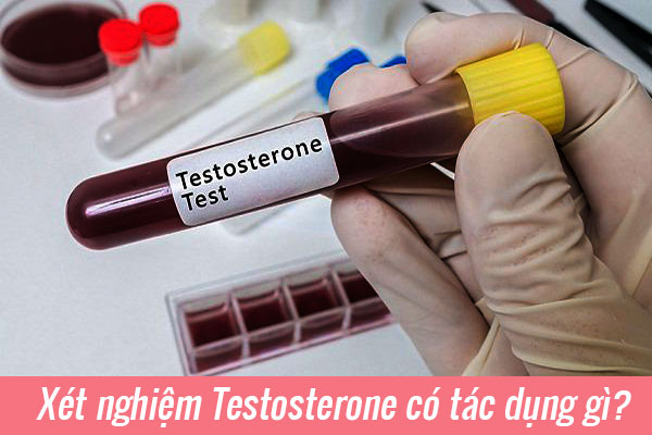 Xét nghiệm Testosterone có tác dụng gì?